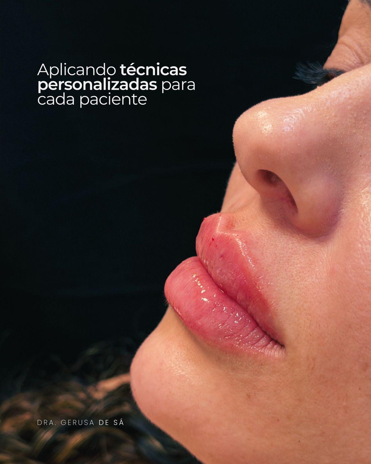 Definição labial
